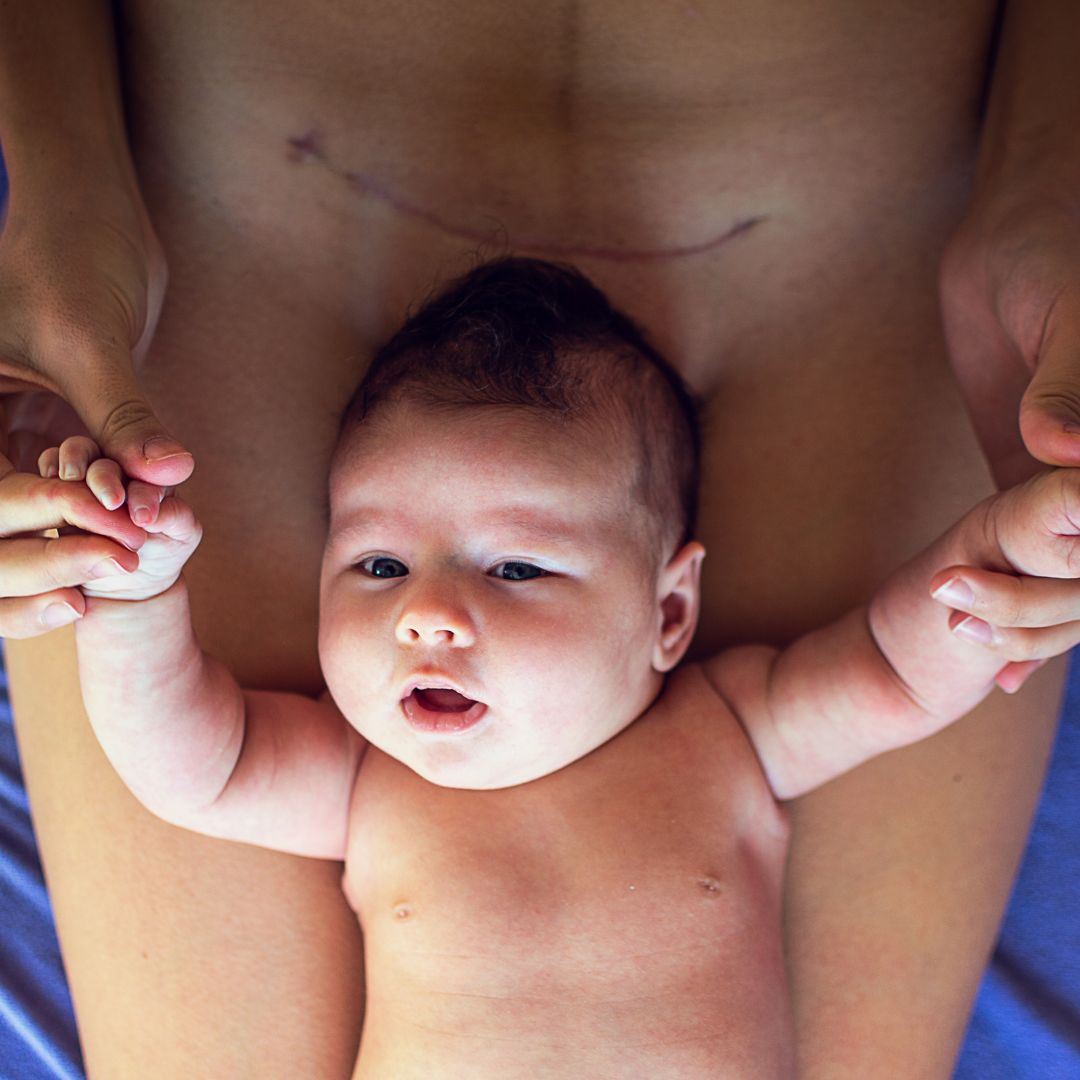 mom with c section and baby beneath the scar