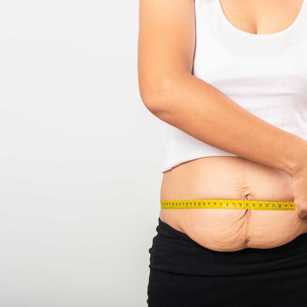 How to Do Postpartum Waist Training Safely After Delivery